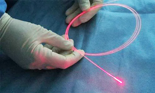 Anorektal Cerrahide Lazer Tedavisi
